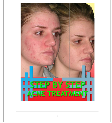 Step By Step Acne Treatment.